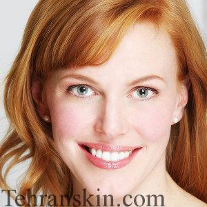 فیتزپاتریک0