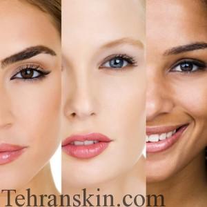 فیتزپاتریک4