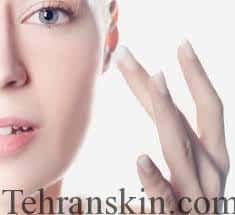 کرم دور چشم0