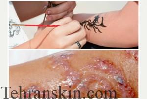 مضرات حنای سیاه