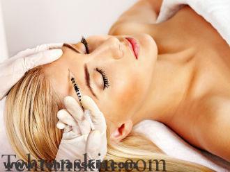 کجا بوتاکس بزنیم؟ | چه موقع بوتاکس بزنیم؟| خطرات تزریق بوتاکس