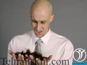 Balding Man Holding Hair