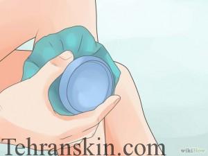 استفاده از کیسه یخ برای کاهش التهاب پوست