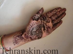 مضرات استفاده از حنا سیاه