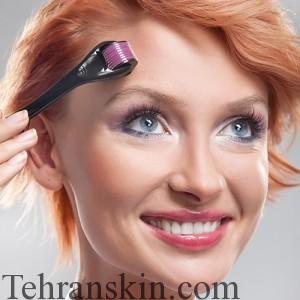 دستگاه های Derma roller ( سوزن های تزریق و غلطک های سوزنی )
