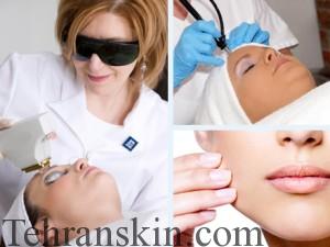 Laser-bigdeloo-Clinic-main