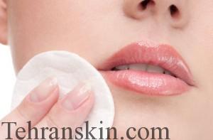 تحریک پوست1