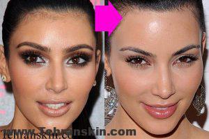 لیزر-بازیگران-معروف-هالیوودی