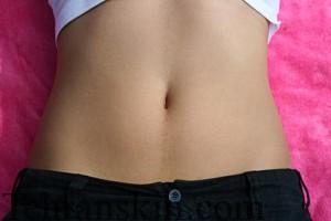 لیزر موهای شکم0