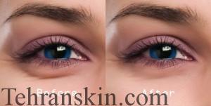 پف چشم6