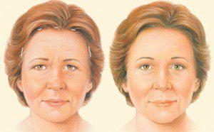 بالا کشیدن ابرو