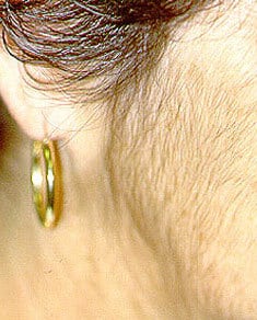 موهای زائد صورت