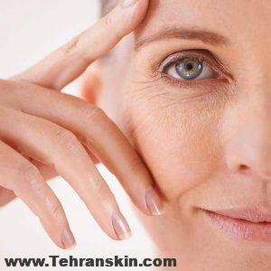 treatments-skin-rejuvenation-fine-lines