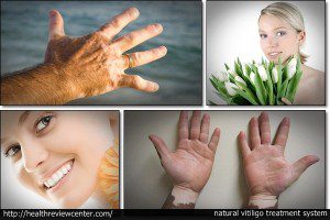 بیماری ب ر ص