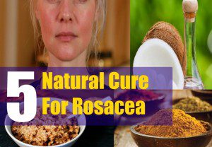 ماسک گیاهی برای درمان روزاسه