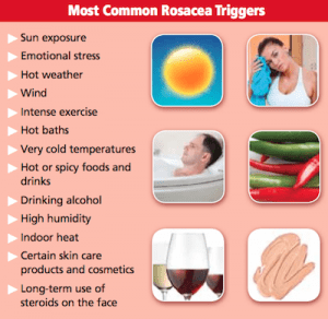 عوامل محرک روزاسه