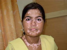 لک و پیس صورت8485