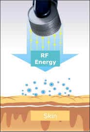 رادیوفرکوئنسی