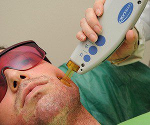 جوانسازی پوست 4