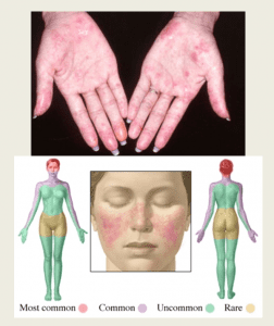 لو پ وس 0958048