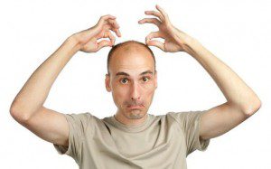 درمان طاسی آقایان