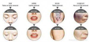 الکساندرایت