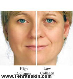 جوانسازی و کلاژن پوست