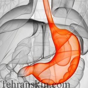 TERI-Stomach-300x300