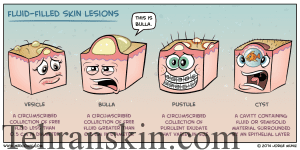 skin lesions