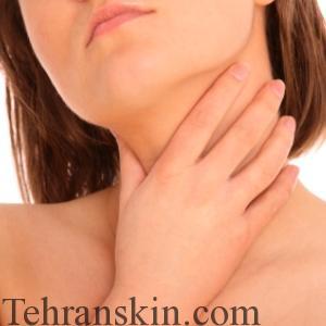 sore-throat-istock_300x300_2