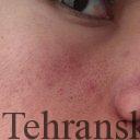 منافذ باز صورت