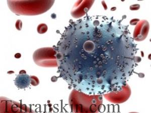 سارکوم کاپسی 2