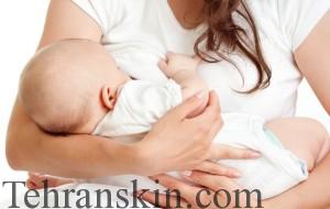 شیردهی و لیزر