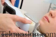 چرا لیزر موهای زائد در گروه پزشکان تهران اسکین بدون درد است؟