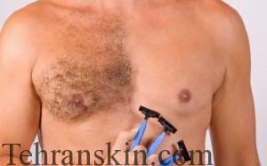 لیزر در ورزشکاران 1