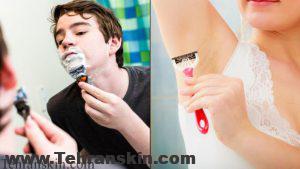 لیزر موهای زائد نوجوانان