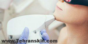 لیزر موهای زائد0