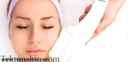 پاسخگویی به سوالات رایج شما در خصوص لیزر موهای زائد(1)