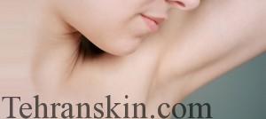 لیزر موهای زیربغل1