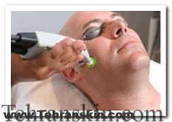 Image result for ‫لیزر دایود‬‎