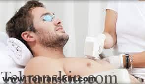 Image result for لیزر دیود برای از بین بردن دائمی موهای زائد