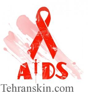 ایدز1