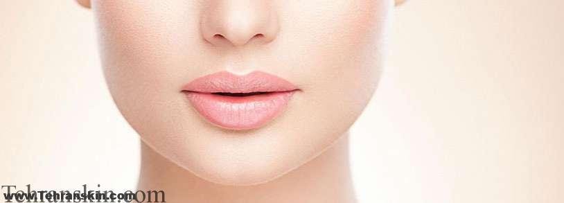 تصویر لیزر موهای نازک