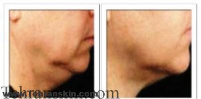 كويتيشن و سوالات متداول آن