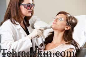لیزردرمانی برای ازبین بردن حلقه سیاه زیرچشم
