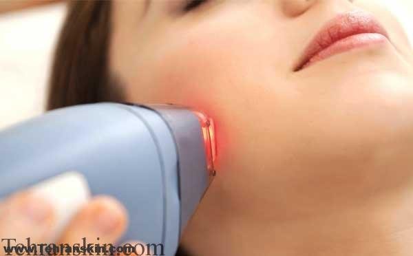 7 سوالی که بهنگام انتخاب کلینیک لیزردرمانی باید پرسید !