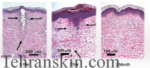 yANvREMzXZnLWHd9I3tlEePdxomTSjs