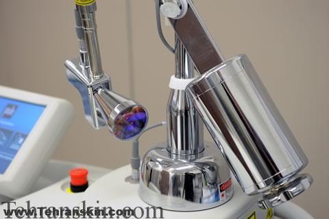 آر اف و ليزر