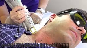 ازمزایای لیزردرمانی سرد و معایب آن چه می دانید؟