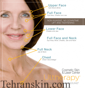 هایفوتراپی